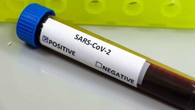 В Алматы коронавирус выявили ещё у одного человека, всего в стране подтверждён 121 случай