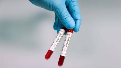 За сутки в Казахстане выявили 907 случаев заражения Covid-19, 929 человек выздоровели