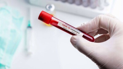 За сутки в Казахстане выявили 704 случая заражения Covid-19, 317 человек выздоровели