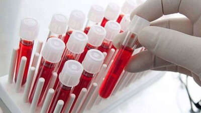 Бекшин: Больницы не используют экспресс-тесты на чувствительность к антибиотикам