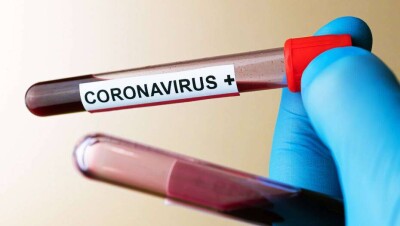 За сутки в Казахстане выявили 872 случая заражения Covid-19, 664 человека выздоровели 