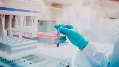 В Словакии на Covid-19 решили протестировать всех граждан страны старше десяти лет