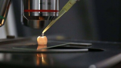 Китайские учёные научились выращивать зубную эмаль