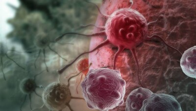 Способ лечения рака нанолазерами разработала группа американских и российских учёных 