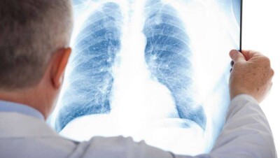 В Казахстане за сутки выявили 228 больных коронавирусной пневмонией