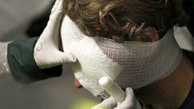 Перелом черепа диагностировали раненому из травматики боксёру в Костанае