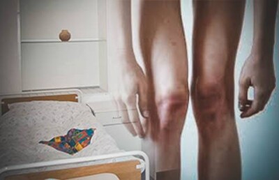 Подопечный психдиспансера в Акмолинской области похудел на 20 кг от недоедания