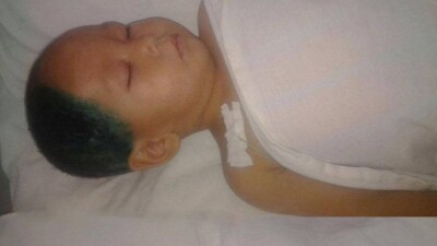 Полиция назначила экспертизу по делу об "избитом няней" двухлетнем мальчике в Алматы