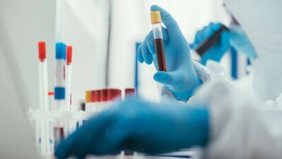 За сутки в Казахстане выявили 76 случаев заражения Covid-19, 155 человек выздоровели