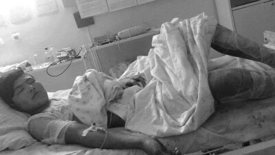 В Костанае скончался от ожогов подросток, которого взрослые отправили смолить голову барана