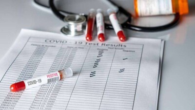 Больше трети казахстанцев не доверяют официальной статистике по коронавирусу