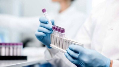 Причину смертельного отравления двоих детей не смогли установить в Шымкенте