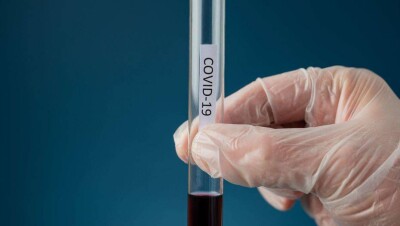 Хронология распространения коронавируса, 26 апреля: массовое заражение на Тенгизе и открытие учёных из Семея