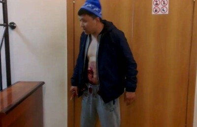 Вспоровший себе живот сотрудник "Казахмыса" рассказал о причинах поступка