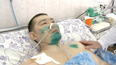 Подставившегося под КамАЗ ради спасения детей полицейского прооперировали