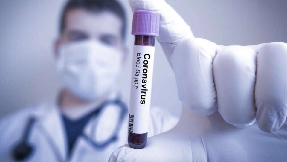 За сутки в Казахстане выявили 476 случаев заражения Covid-19, 1877 человек выздоровели