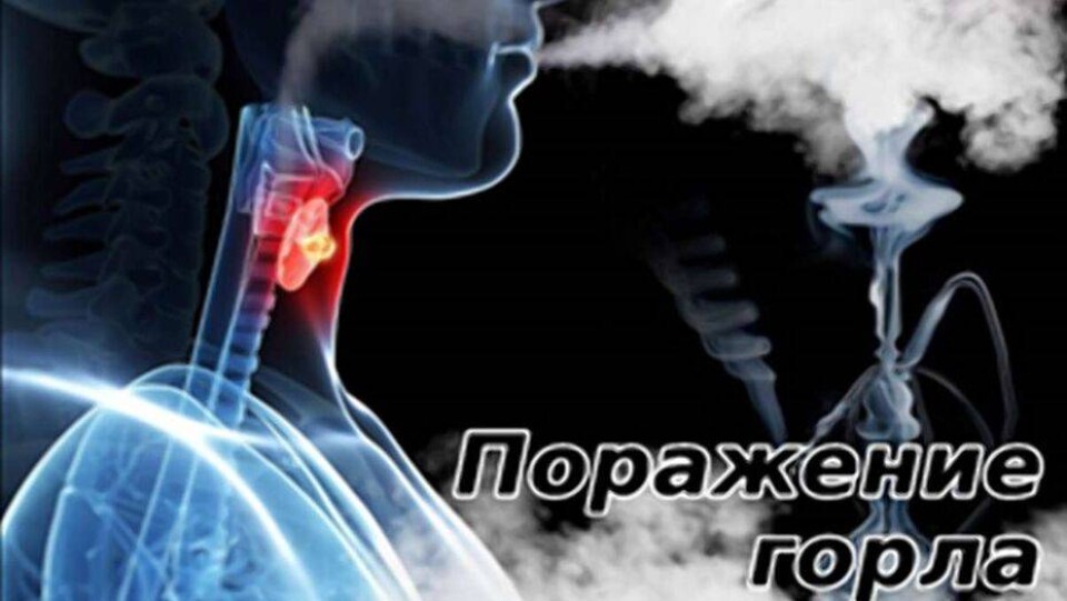 Минздрав разработал эскизы, предупреждающие о вреде сигарет и кальянов