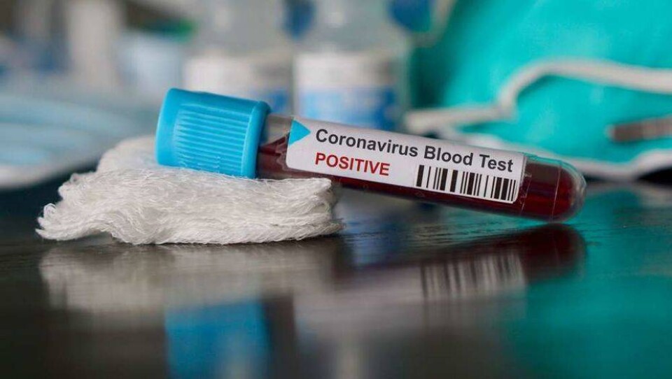 В Жамбылской области Covid-19 выявили ещё у девяти вахтовиков из Тенгиза, у одного – в Лисаковске
