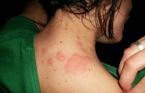 Фото с сайта nasekomyh.net