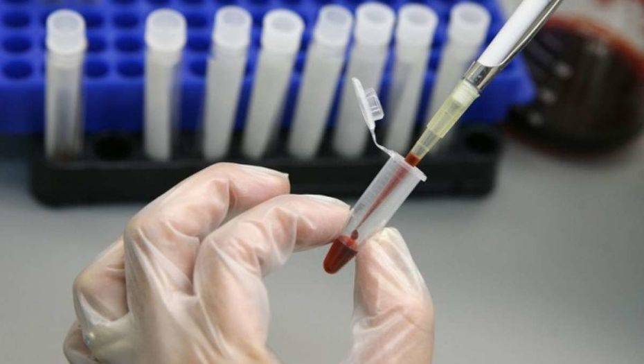 После массового заражения людей гепатитом в Караганде завели уголовное дело