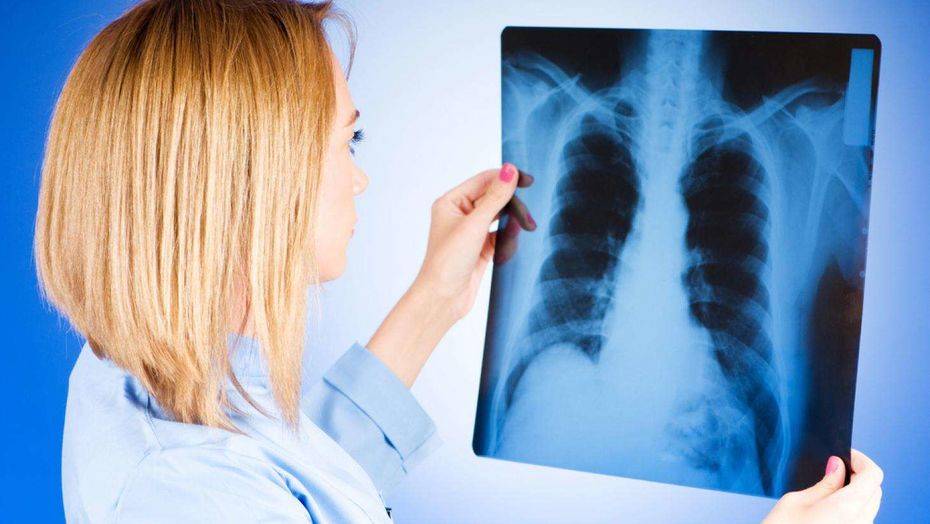 В детском саду Караганды выявили воспитателя с туберкулёзом