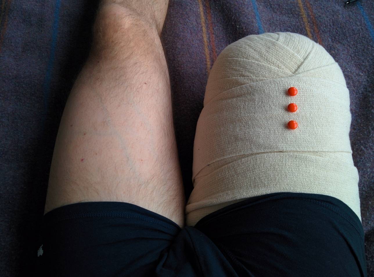 Даже потеря ноги не сделала Мухтара менее привлекательным в глазах возлюбленной